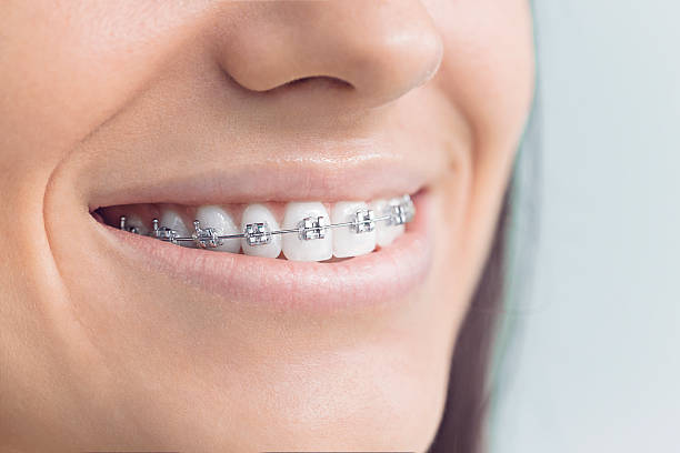 Best Full Mouth Reconstruction  in Plattsburg, MO